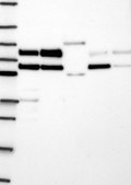 Anti-LIMD1 antibody produced in rabbit Prestige Antibodies&#174; Powered by Atlas Antibodies, affinity isolated antibody, buffered aqueous glycerol solution