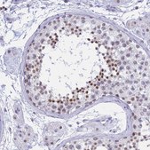 Anti-KLF14 antibody produced in rabbit Prestige Antibodies&#174; Powered by Atlas Antibodies, affinity isolated antibody, buffered aqueous glycerol solution