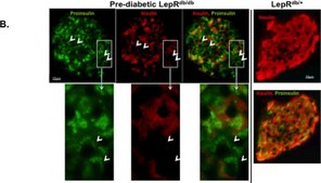 Monoclonal Anti-Insulin antibody produced in mouse clone K36AC10, ascites fluid