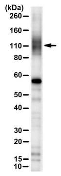 Anti-ANO6/TMEM16F