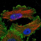 Anti-YES1 antibody produced in rabbit Prestige Antibodies&#174; Powered by Atlas Antibodies, affinity isolated antibody, buffered aqueous glycerol solution
