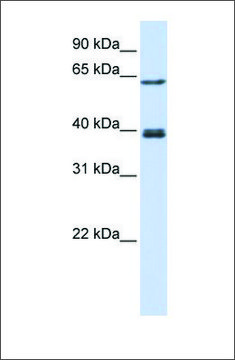 Anti-IKZF3 antibody produced in rabbit affinity isolated antibody