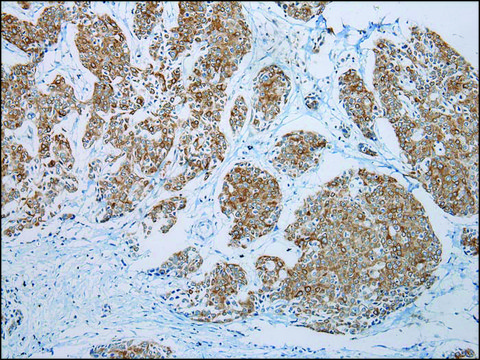 Anti-FGF6 affinity isolated antibody