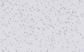 Anti-Amyloid &#946;42/40 Antibody, clone W0-2 ZooMAb&#174; Mouse Monoclonal recombinant, expressed in HEK 293 cells