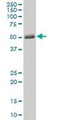 Anti-MMP1 antibody produced in mouse purified immunoglobulin, buffered aqueous solution