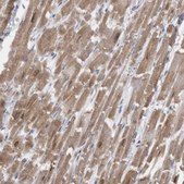 Anti-CAMK2D antibody produced in rabbit Prestige Antibodies&#174; Powered by Atlas Antibodies, affinity isolated antibody, buffered aqueous glycerol solution