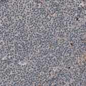 Monoclonal Anti-LAMA1 antibody produced in mouse Prestige Antibodies&#174; Powered by Atlas Antibodies, clone CL2968, purified immunoglobulin, buffered aqueous glycerol solution