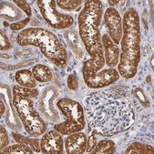 Anti-PGRMC1 antibody produced in rabbit Prestige Antibodies&#174; Powered by Atlas Antibodies, affinity isolated antibody, buffered aqueous glycerol solution