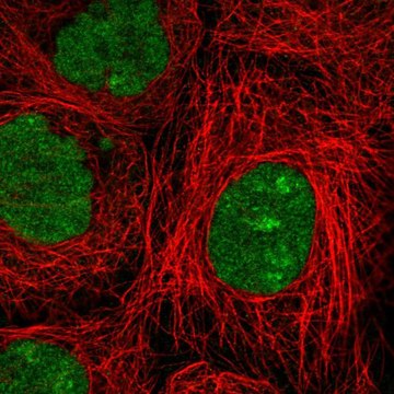 Anti-NSMCE2 antibody produced in rabbit affinity isolated antibody