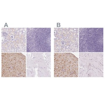 Anti-IGFBP1 antibody produced in rabbit Prestige Antibodies&#174; Powered by Atlas Antibodies, affinity isolated antibody, buffered aqueous glycerol solution