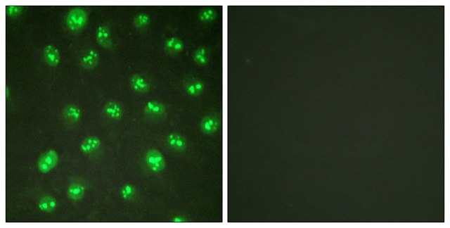 Anti-p57 KIP2 antibody produced in rabbit affinity isolated antibody