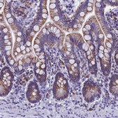 Anti-SLC8B1 antibody produced in rabbit Prestige Antibodies&#174; Powered by Atlas Antibodies, affinity isolated antibody, buffered aqueous glycerol solution
