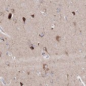 Anti-GLS antibody produced in rabbit Prestige Antibodies&#174; Powered by Atlas Antibodies, affinity isolated antibody, buffered aqueous glycerol solution