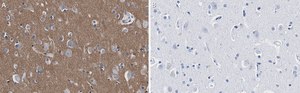 Anti-CD56 Antibody, clone 3F5 ZooMAb&#174; Rabbit Monoclonal recombinant, expressed in HEK 293 cells