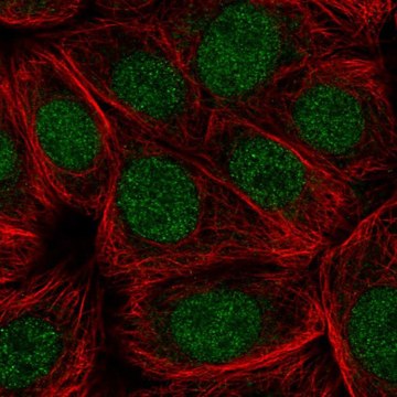 Anti-CDC73 antibody produced in rabbit Prestige Antibodies&#174; Powered by Atlas Antibodies, affinity isolated antibody