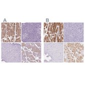 Anti-MYOM1 antibody produced in rabbit Prestige Antibodies&#174; Powered by Atlas Antibodies, affinity isolated antibody, buffered aqueous glycerol solution