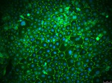 16HBE14o- Human Bronchial Epithelial Cell Line 16HBE14o- human bronchial epithelial cell line is widely used to model barrier function of the airway epithelium and to study respiratory ion transport as well as the function of CFTR.