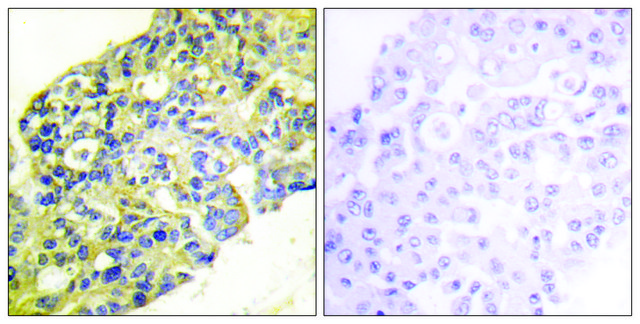 Anti-PI3-kinase p85-&#945; antibody produced in rabbit affinity isolated antibody