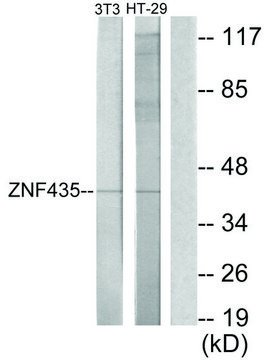 Anti-ZNF435 antibody produced in rabbit affinity isolated antibody