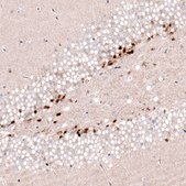 Monoclonal Anti-SOX4 antibody produced in mouse Prestige Antibodies&#174; Powered by Atlas Antibodies, clone CL5634, purified immunoglobulin, buffered aqueous glycerol solution