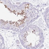 Anti-ACR antibody produced in rabbit Prestige Antibodies&#174; Powered by Atlas Antibodies, affinity isolated antibody, buffered aqueous glycerol solution