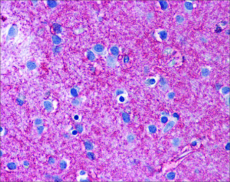 Anti-SLC1A2 antibody produced in rabbit affinity isolated antibody