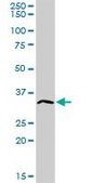 Anti-ATP4B antibody produced in rabbit purified immunoglobulin, buffered aqueous solution