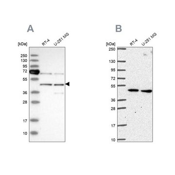 Anti-SLC25A24 antibody produced in rabbit Prestige Antibodies&#174; Powered by Atlas Antibodies, affinity isolated antibody, buffered aqueous glycerol solution