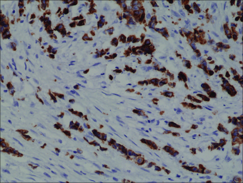 Anti-Cytokeratin 19 (CK-19) antibody, Rabbit monoclonal recombinant, expressed in HEK 293 cells, clone RM364, purified immunoglobulin