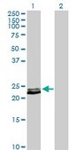 Anti-PRL antibody produced in rabbit purified immunoglobulin, buffered aqueous solution