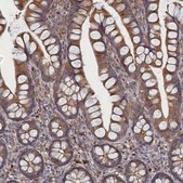 Anti-FILIP1L antibody produced in rabbit Prestige Antibodies&#174; Powered by Atlas Antibodies, affinity isolated antibody, buffered aqueous glycerol solution