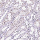 Anti-HSD11B1 antibody produced in rabbit Prestige Antibodies&#174; Powered by Atlas Antibodies, affinity isolated antibody, buffered aqueous glycerol solution