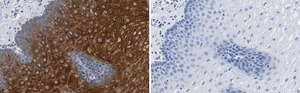 Anti-Involucrin Antibody, clone 1D13 ZooMAb&#174; Rabbit Monoclonal recombinant, expressed in HEK 293 cells