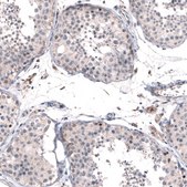 Anti-FOXM1 antibody produced in rabbit Prestige Antibodies&#174; Powered by Atlas Antibodies, affinity isolated antibody, buffered aqueous glycerol solution