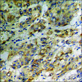 Anti-phospho-CRYAB/Crystallin-&#945;-B (pSer59) antibody produced in rabbit affinity isolated antibody