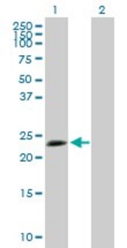 Anti-TPD52L1 antibody produced in mouse purified immunoglobulin, buffered aqueous solution