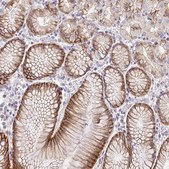 Anti-SLC9A1 antibody produced in rabbit Prestige Antibodies&#174; Powered by Atlas Antibodies, affinity isolated antibody, buffered aqueous glycerol solution