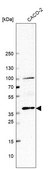 Anti-BMP2 antibody produced in rabbit Prestige Antibodies&#174; Powered by Atlas Antibodies, affinity isolated antibody