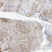 Anti-HHATL antibody produced in rabbit Prestige Antibodies&#174; Powered by Atlas Antibodies, affinity isolated antibody, buffered aqueous glycerol solution