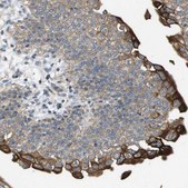 Anti-KRT23 antibody produced in rabbit Prestige Antibodies&#174; Powered by Atlas Antibodies, affinity isolated antibody, buffered aqueous glycerol solution