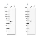 Anti-BHMT antibody produced in rabbit Prestige Antibodies&#174; Powered by Atlas Antibodies, affinity isolated antibody, buffered aqueous glycerol solution