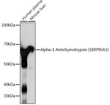 Anti-Alpha-1 Antichymotrypsin (SERPINA3) antibody produced in rabbit