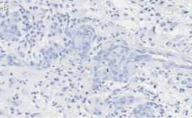 Anti-p-PTEN (Tyr240) Antibody, clone 3G6 ZooMAb&#174; Rabbit Monoclonal recombinant, expressed in HEK 293 cells