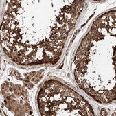 Anti-PISD antibody produced in rabbit Prestige Antibodies&#174; Powered by Atlas Antibodies, affinity isolated antibody, buffered aqueous glycerol solution, ab1