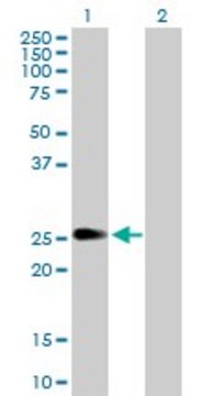 Anti-PIP5K1C antibody produced in rabbit purified immunoglobulin, buffered aqueous solution