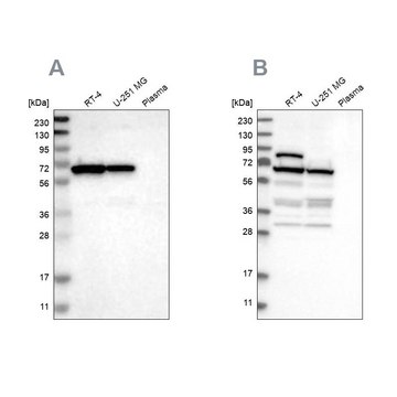 Anti-NOP58 antibody produced in rabbit Prestige Antibodies&#174; Powered by Atlas Antibodies, affinity isolated antibody, buffered aqueous glycerol solution