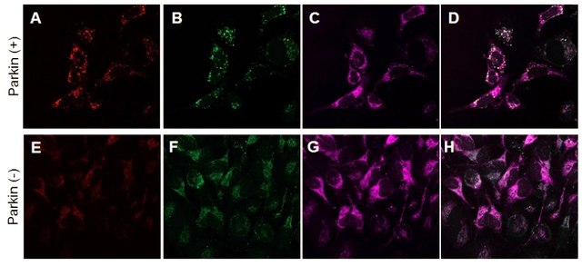 BioTracker&#8482; Mitophagy Detection Kit