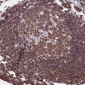 Anti-CORO1A antibody produced in rabbit Prestige Antibodies&#174; Powered by Atlas Antibodies, affinity isolated antibody, buffered aqueous glycerol solution