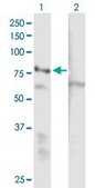 Anti-EHHADH antibody produced in mouse IgG fraction of antiserum, buffered aqueous solution