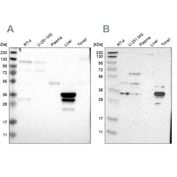 Anti-PHYH antibody produced in rabbit Prestige Antibodies&#174; Powered by Atlas Antibodies, affinity isolated antibody, buffered aqueous glycerol solution